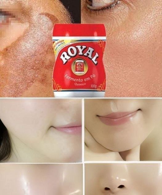 Receita para Diminuir Manchas e Rugas
