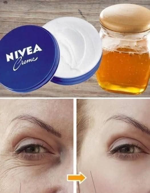 Acabe com rugas e manchas